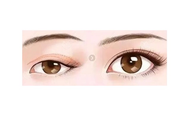 徐州二院哪個醫(yī)生做雙眼皮好？陶常波、張愛君等實力過硬