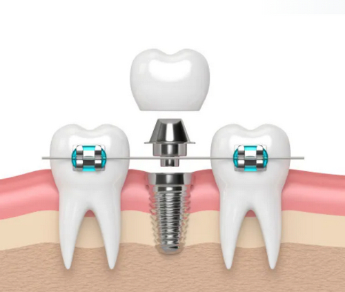 截圖14467.jpg 截圖14467.jpg