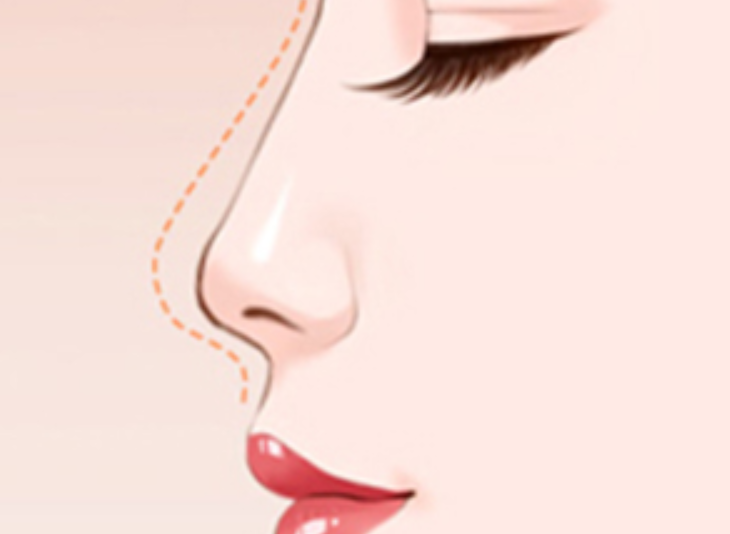 圖片.png 圖片.png