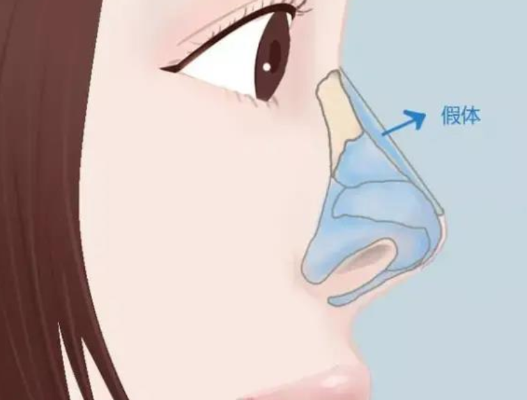 圖片.png 圖片.png