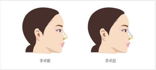 src=http%3A%2F%2Fsh.mylike.com%2Fuploads%2Fallimg%2F170111%2F5-1F1110956394U.jpg&refer=http%3A%2