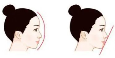 隆鼻5 (2).png 隆鼻5 (2).png