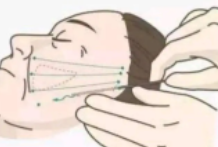 面部溶脂7.png 面部溶脂7.png