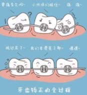 牙齒矯正12.png 牙齒矯正12.png
