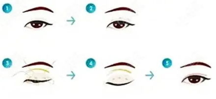 雙眼皮10 (2).png 雙眼皮10 (2).png