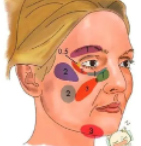 面部溶脂10.png 面部溶脂10.png