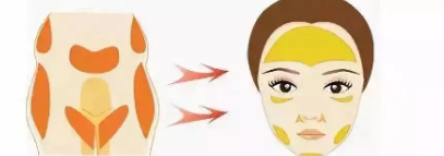 面部溶脂5.png 面部溶脂5.png